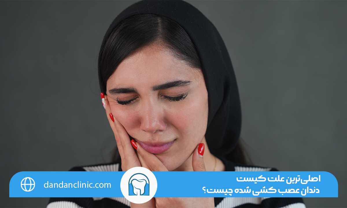 کیست دندان عصب کشی شده
